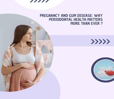 Pregnancy and Gum Disease
